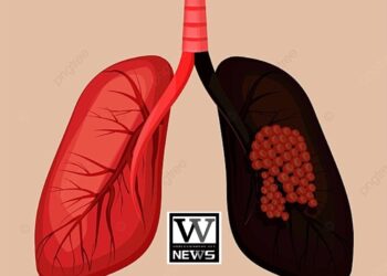 国民健康署扩大肺癌筛检服务，下修具肺癌家族史者筛检年龄(男性45岁、女性40岁)，并放宽重度吸烟者条件