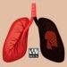 国民健康署扩大肺癌筛检服务，下修具肺癌家族史者筛检年龄(男性45岁、女性40岁)，并放宽重度吸烟者条件