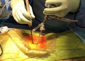 微创手术进行中